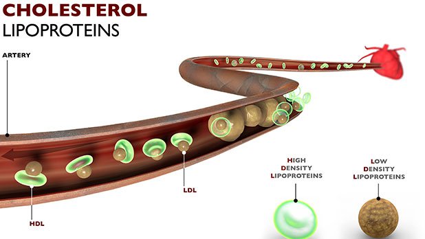 Cholesterol - Lipoproteins